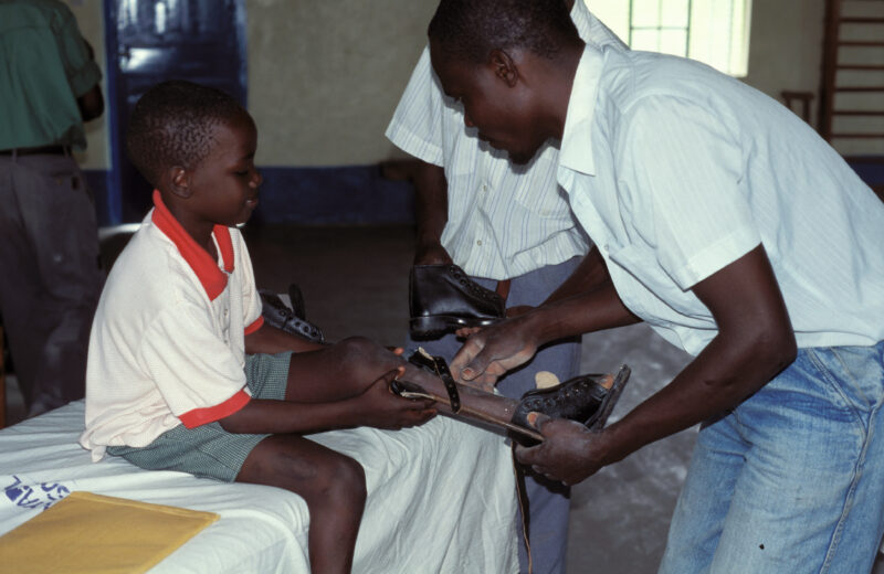 Disabled Child in Kenya — Stock image of child with disability finding hope and hepl at the Nyburi center for disabled children in Kenya. — Children, disabil...