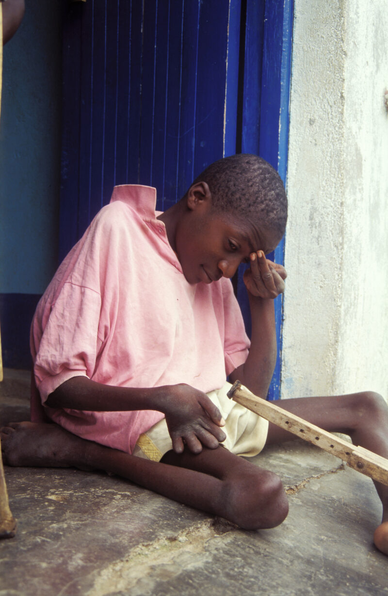 Disabled Child in Kenya — Stock image of child with disability finding hope and hepl at the Nyburi center for disabled children in Kenya. — Children, disabil...