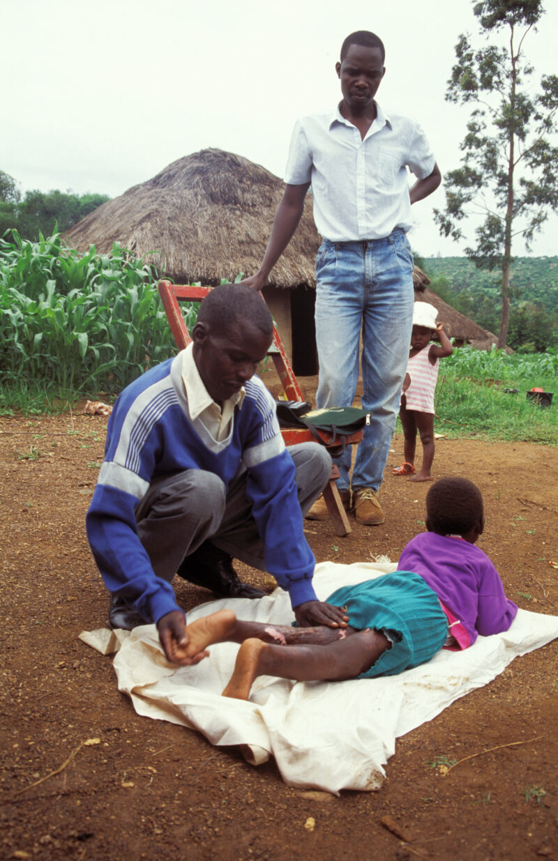Disabled Child in Kenya — Stock image of child with disability finding hope and hepl at the Nyburi center for disabled children in Kenya. — Children, disabil...