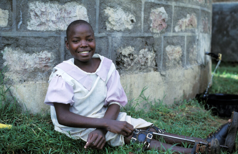 Disabled Child in Kenya — Stock image of child with disability finding hope and hepl at the Nyburi center for disabled children in Kenya. — Children, disabil...