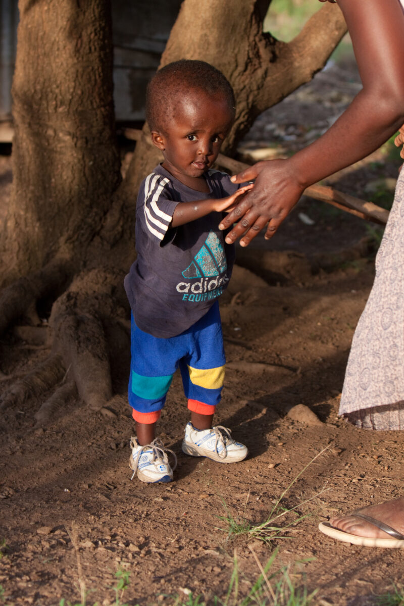 Disabled Child in Kenya — Children with disabilities participate in a program sponsored by ADRA in Western Kenya, Kendu Bay — Kenya, Africa, ADRA, AID, Assis...