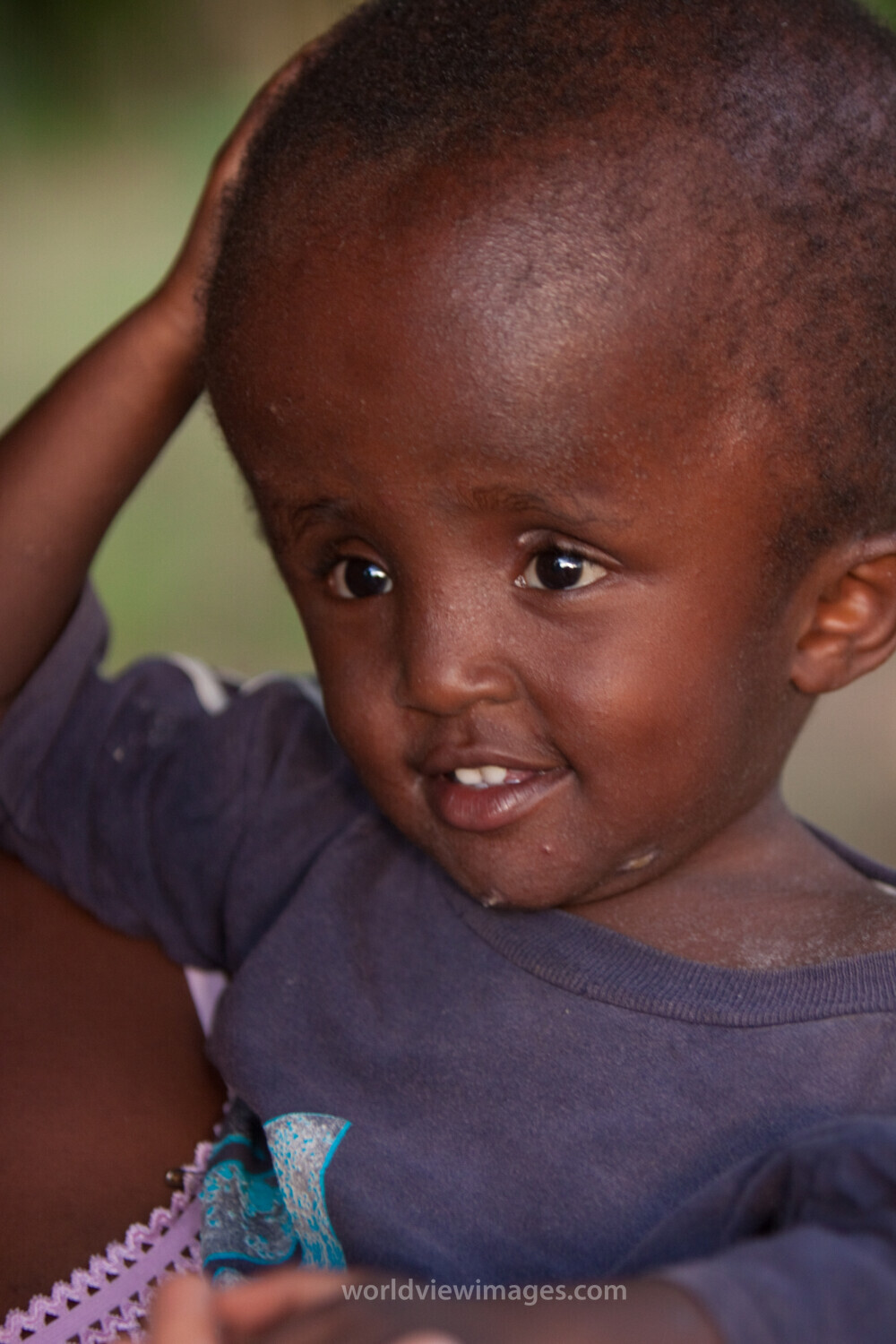 Disabled Child in Kenya