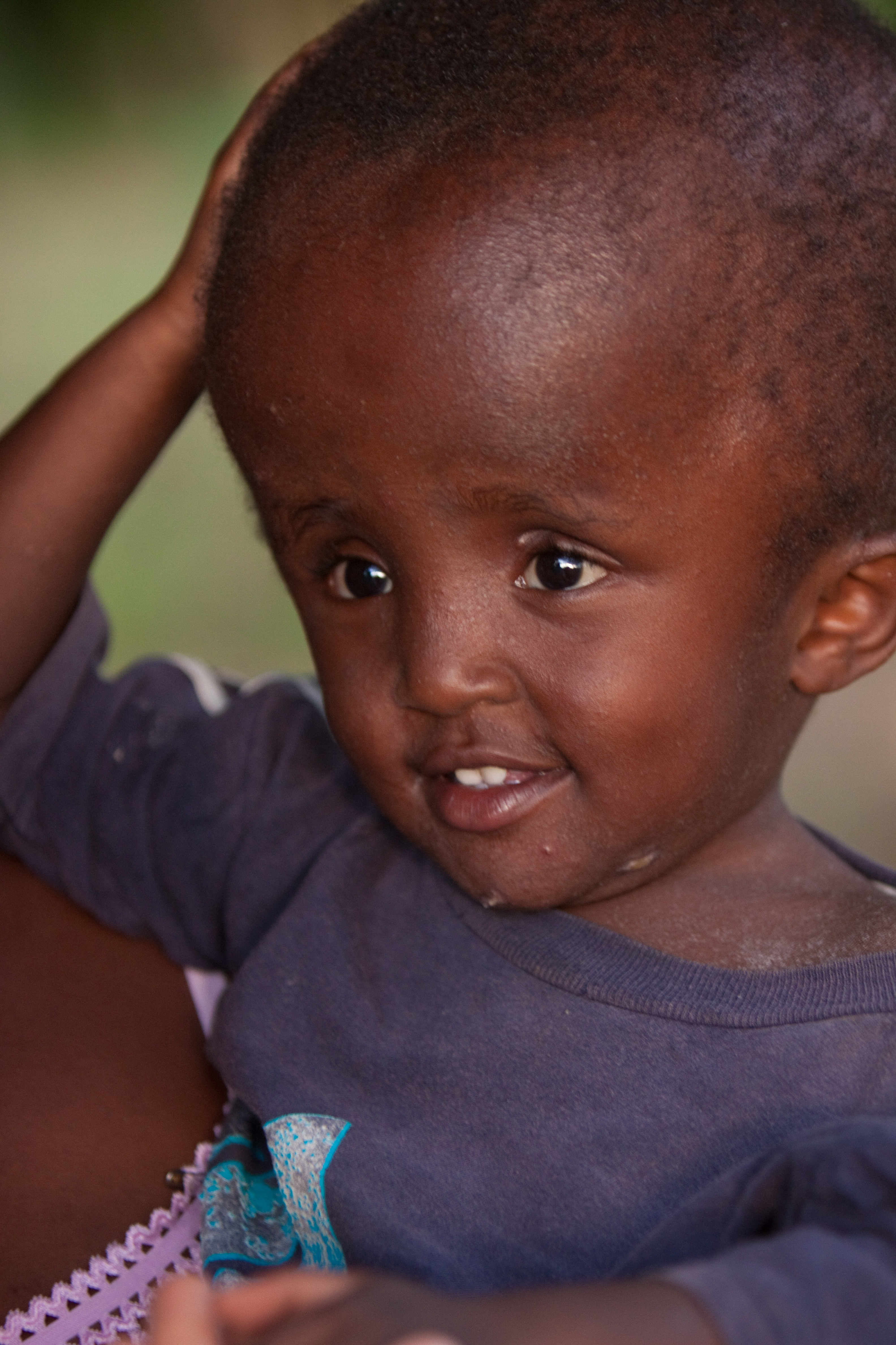 Disabled Child in Kenya