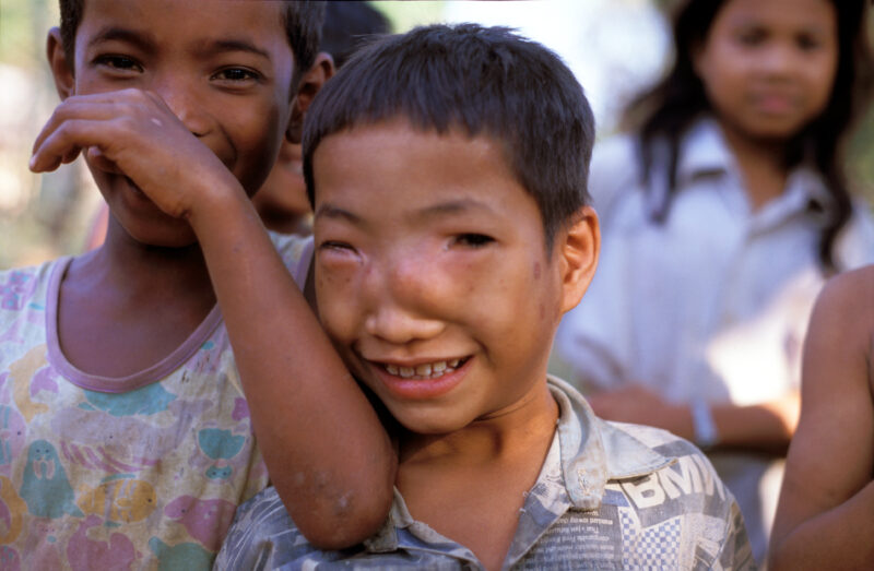 Boy in Cambodia — Cambodia, boy, children, Disability