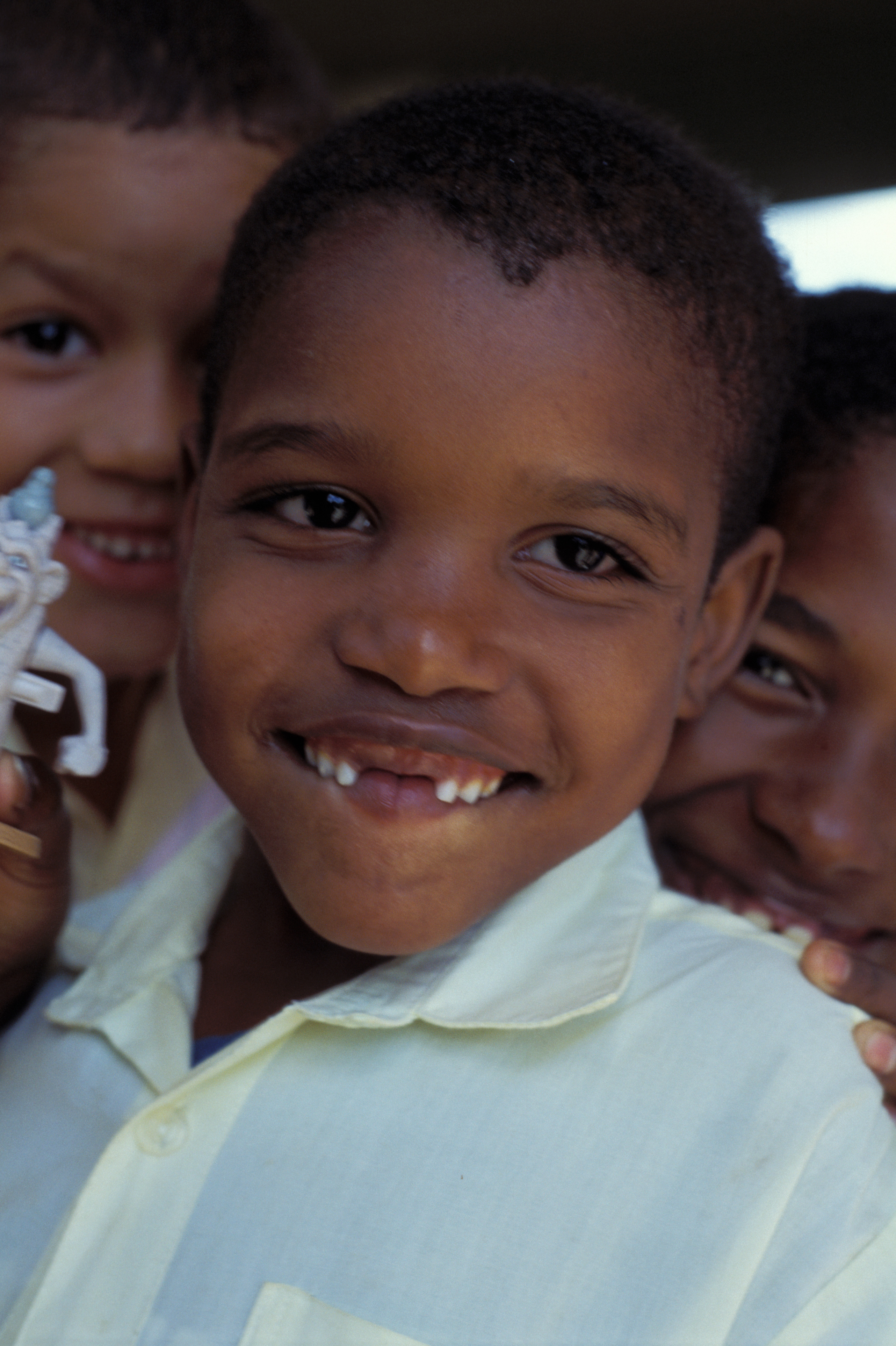 Boy with Missing Teeth