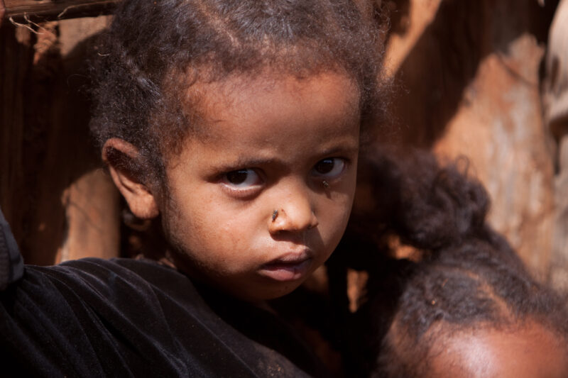 Child in Poverty in Ethiopia — Stock image of a child growing up in poverty in Ethiopia — Ethiopia, Africa, African, Africans, Ethiopian