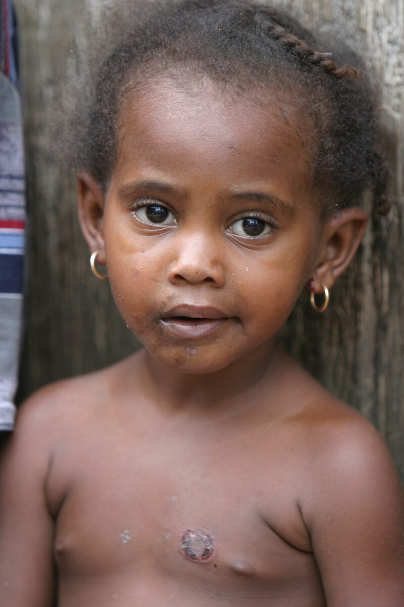 Girl in Sao Tome — Children living in rural Sao Tome, an Island of the coast of West Africa — Sao Tome, Africa, ADRA, Poverty, children
