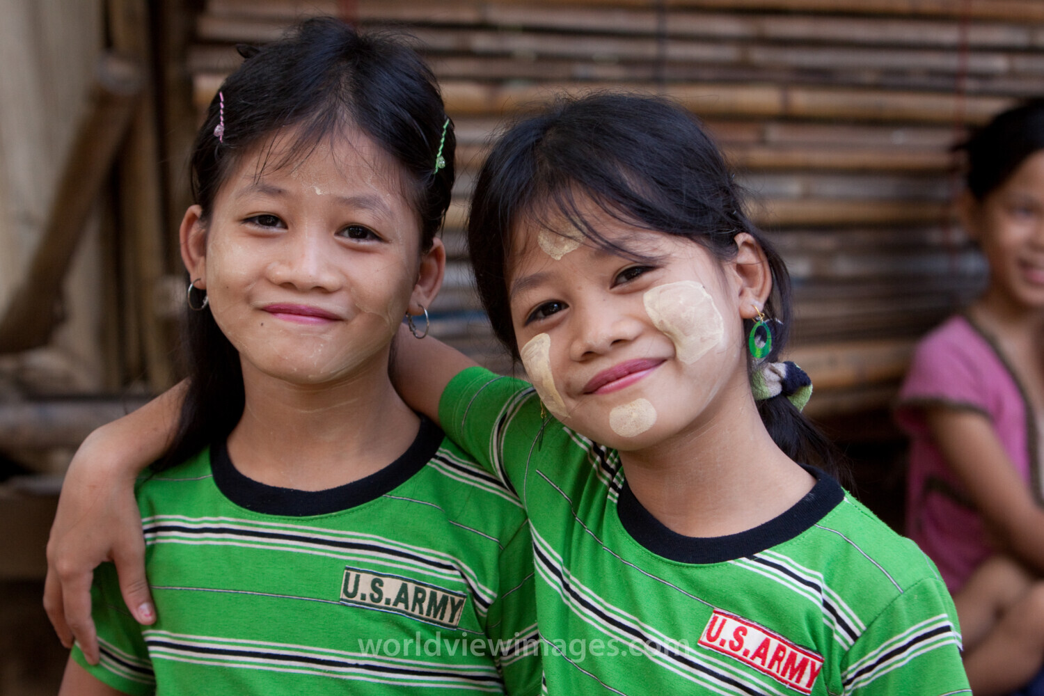 Twins in a Refugee Camp