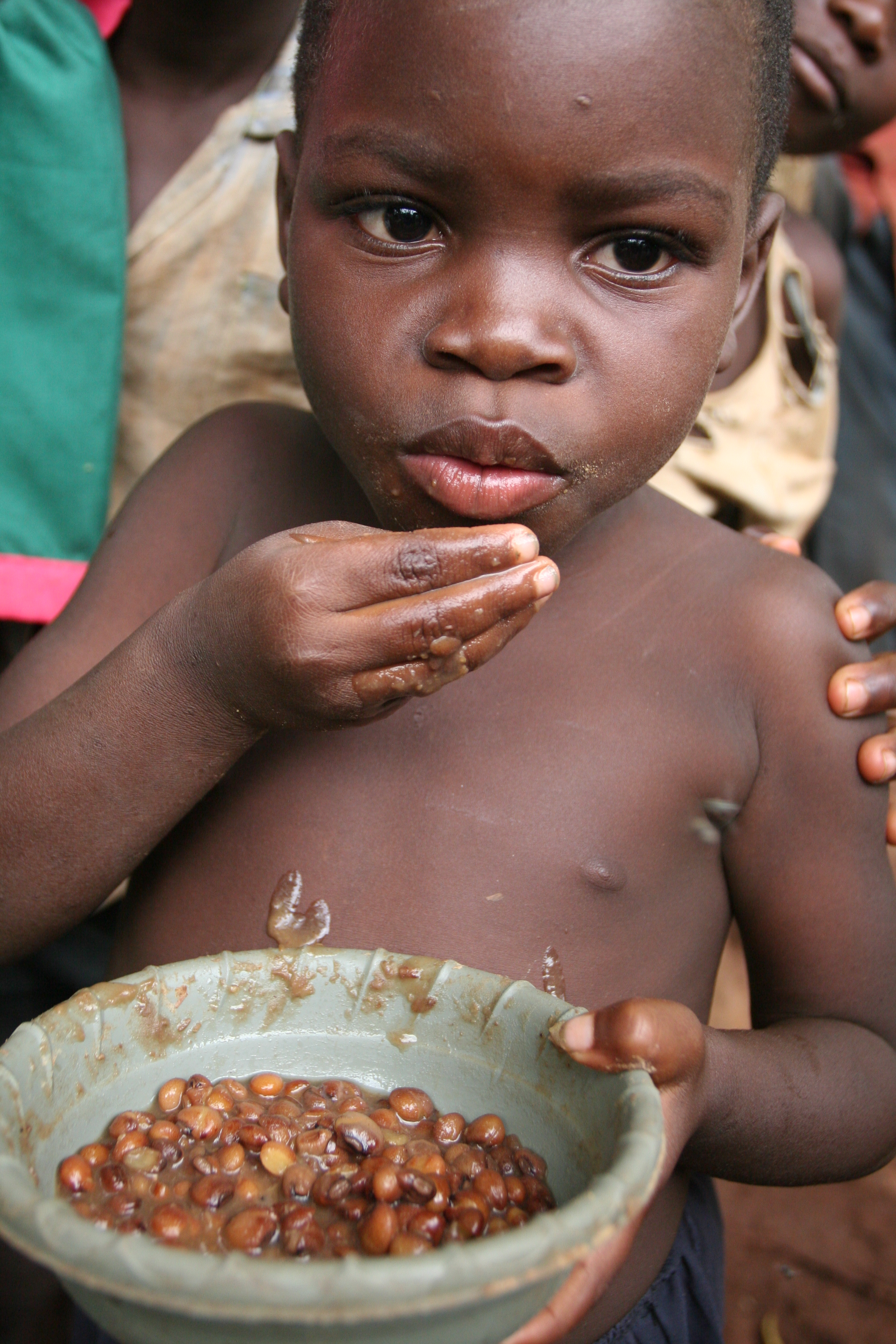 Boy eats beans in Malawi