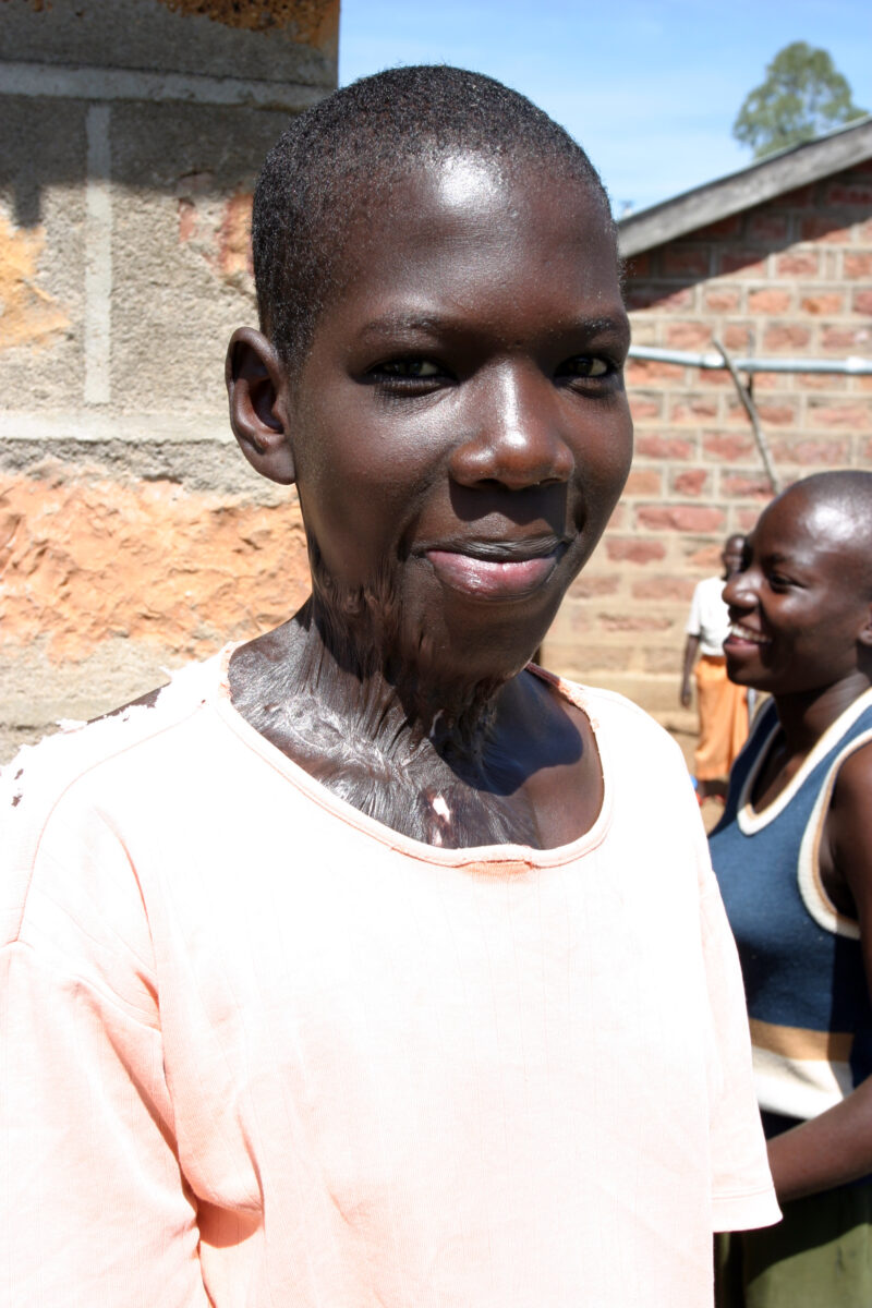 Children with Disabilities — Kenya, Africa, ADRA, Children with disabilities, Children