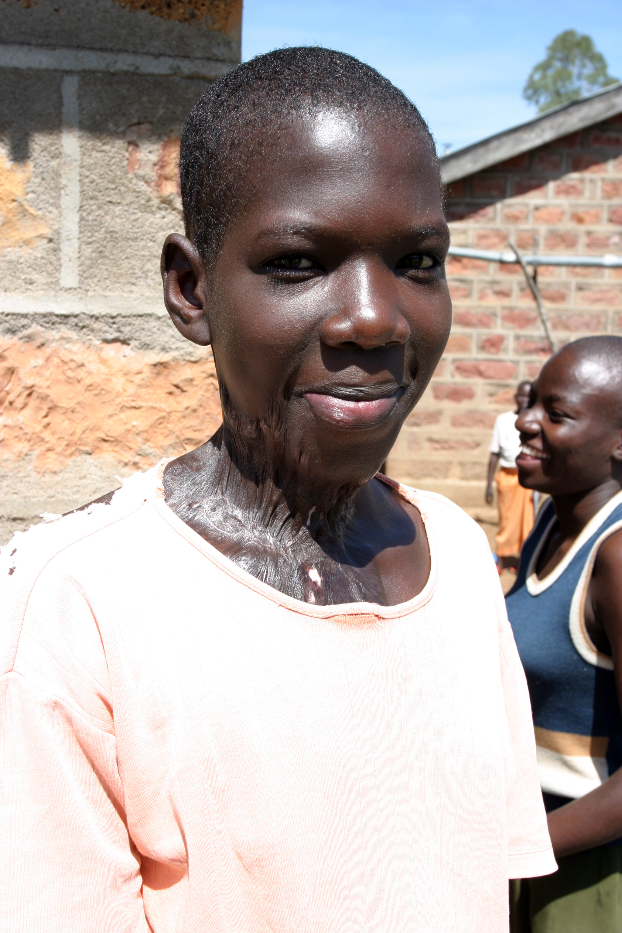 Children with Disabilities