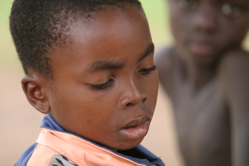 WVI_016510 — Togo, Africa, West Africa, children, poor