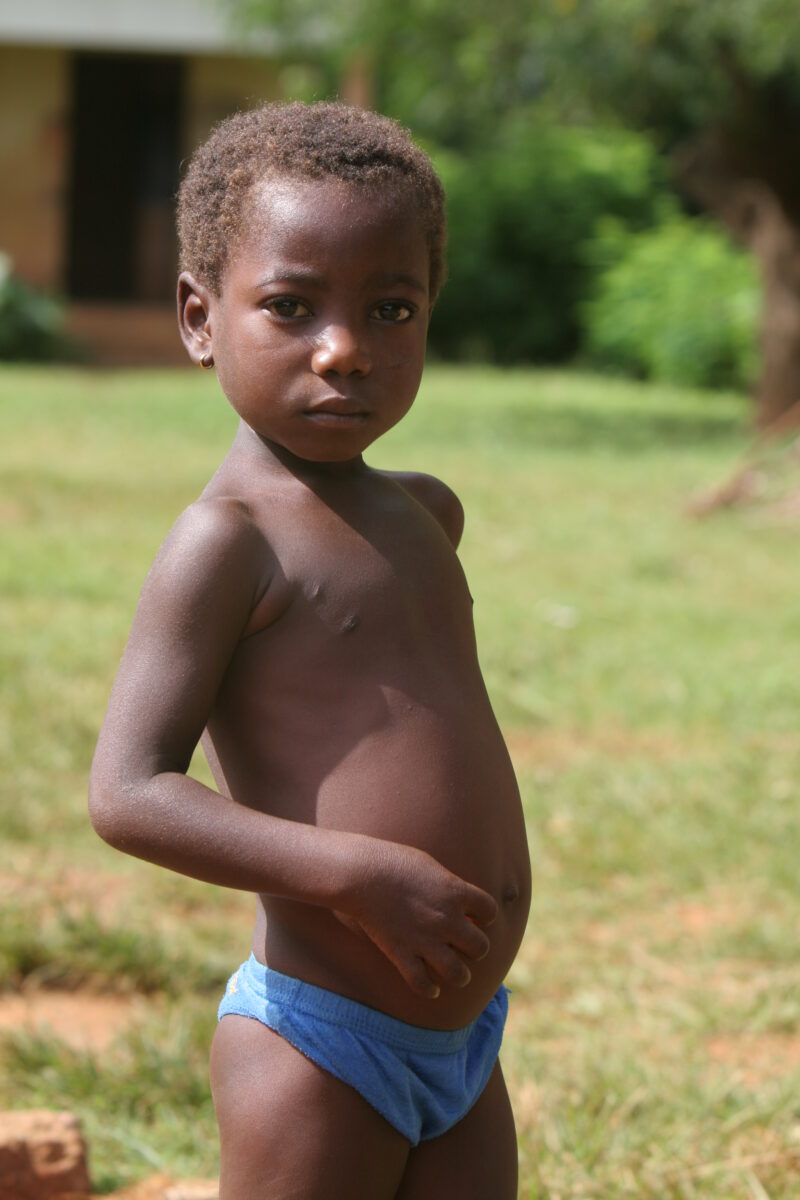 WVI_016543 — Togo, Africa, West Africa, children, poor