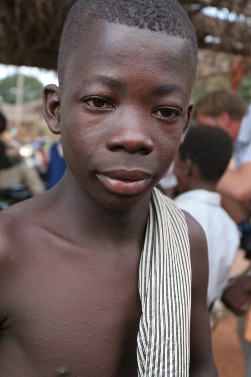 WVI_016687 — Togo, Africa, West Africa
