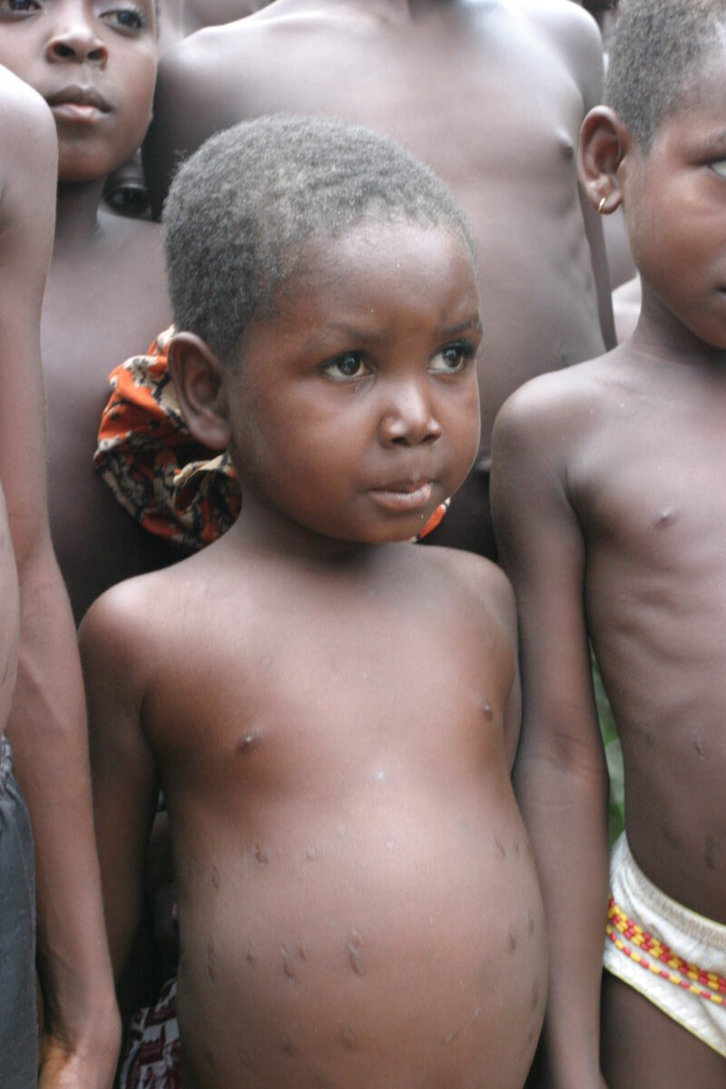 Living in Poverty — People living in a remote village in Togo that has not yet benifited from the work of any Education or assistance from international Deve...