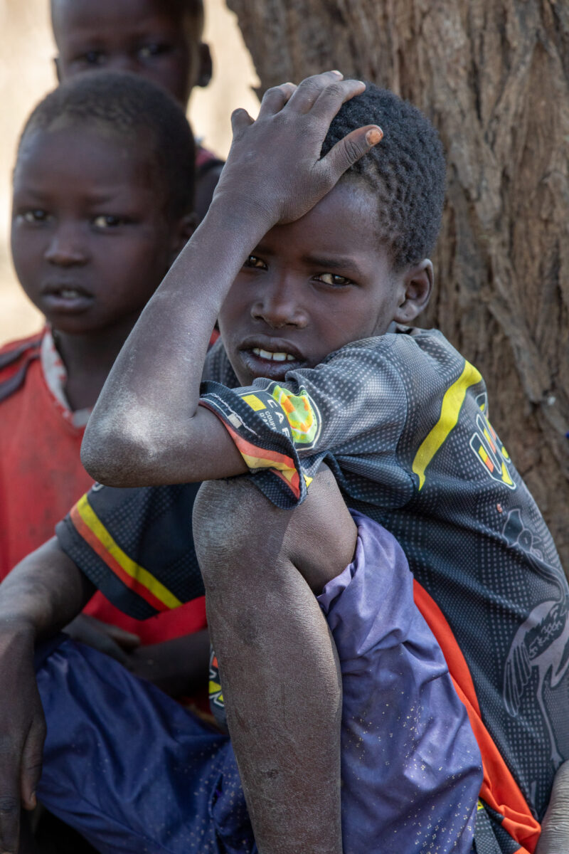 Children in South Sudan — Eyes Open, Frontal Face, Male, Person, Teenager / Young Adult