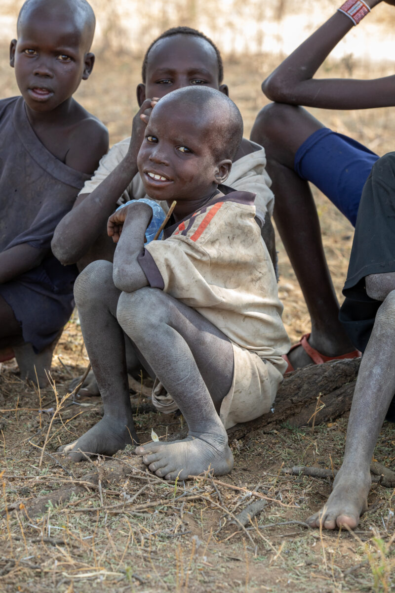 South_Sudan_2024_-216 — Child, Eyes Open, Frontal Face, Male, Person