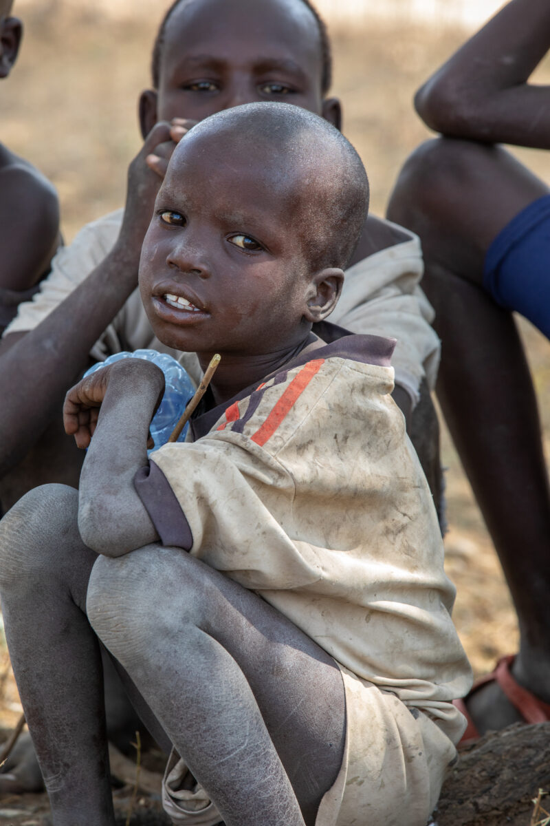 South_Sudan_2024_-217 — Adult, Eyes Open, Frontal Face, Male, One Face